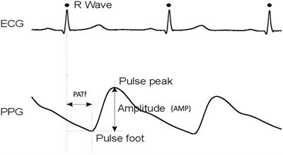 Quantifying the Delays Between Multi-Site Photoplethysmography Pulse and Electrocardiogram R-R Interval Changes Under Slow-Paced Breathing